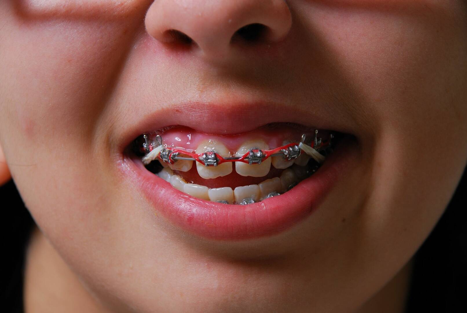 Andover Family Dentistry